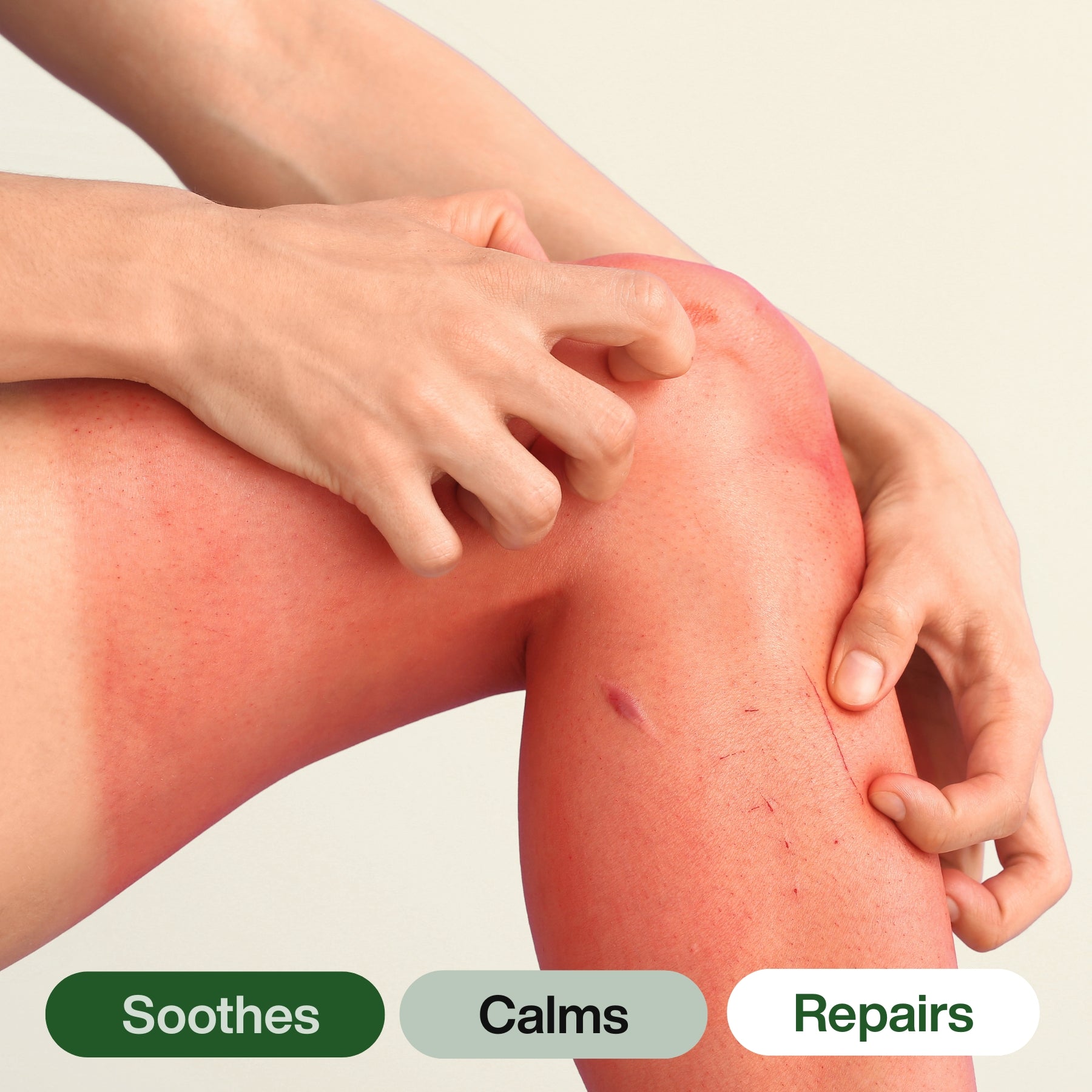 Person scratching an itchy rash on their leg with text indicating 'Soothes', 'Calm', and 'Repairs'. My Skinfood heal and soothe salve balm